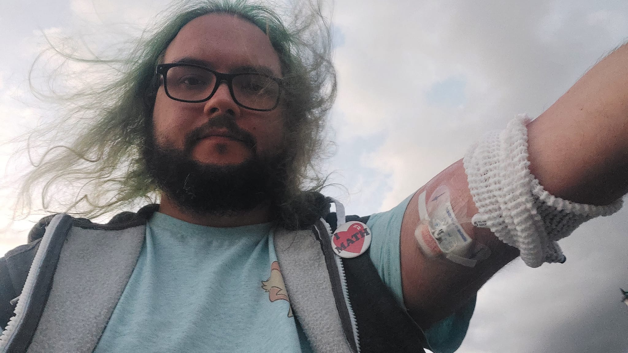 A man with green hair and a beard is outside showing off his PICC without the mesh cover